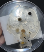 Dorm Maintenance Series: Past Issues With Mold